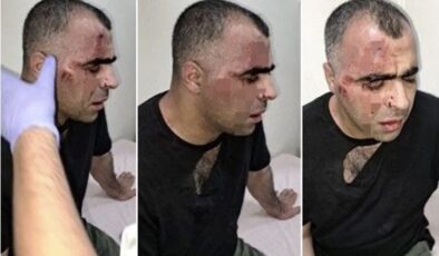 Polis gözetiminde gazeteciye dayak