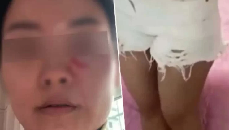 Kısa şort giyen gelinin üzerine kaynar su döktü