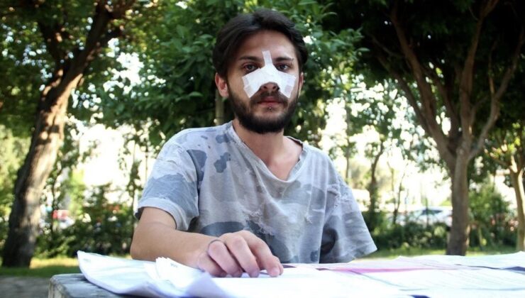 Ev sahibi ve oğulları,  zorla dışarı attıkları  kiracılarının burnu kırdı