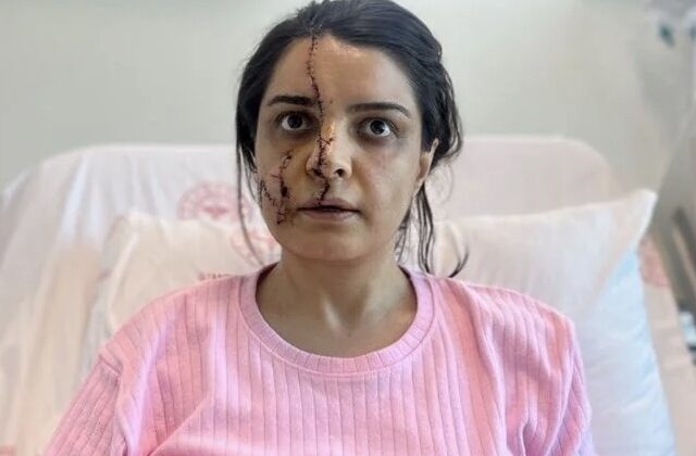 Dehşeti yaşadı, canını zor kurtardı!