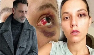 Oyuncu Ozan Güven, darp ve bir mekandan kovulma olayı ilgili ilk kez konuştu