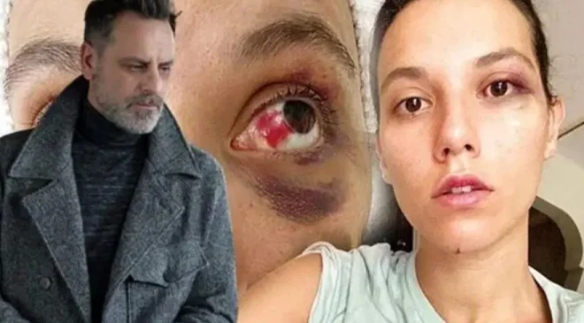 Oyuncu Ozan Güven, darp ve bir mekandan kovulma olayı ilgili ilk kez konuştu
