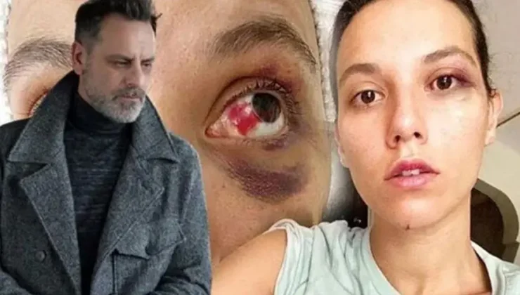 Oyuncu Ozan Güven, darp ve bir mekandan kovulma olayı ilgili ilk kez konuştu